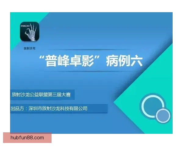 世界杯足球竞猜平台全面升级 智能分析助力精准预测 赢取丰厚大奖